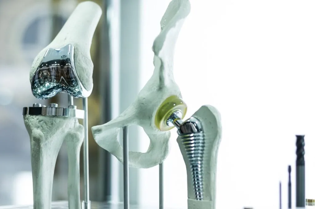 Titanium Grade 23 in Medical Implants