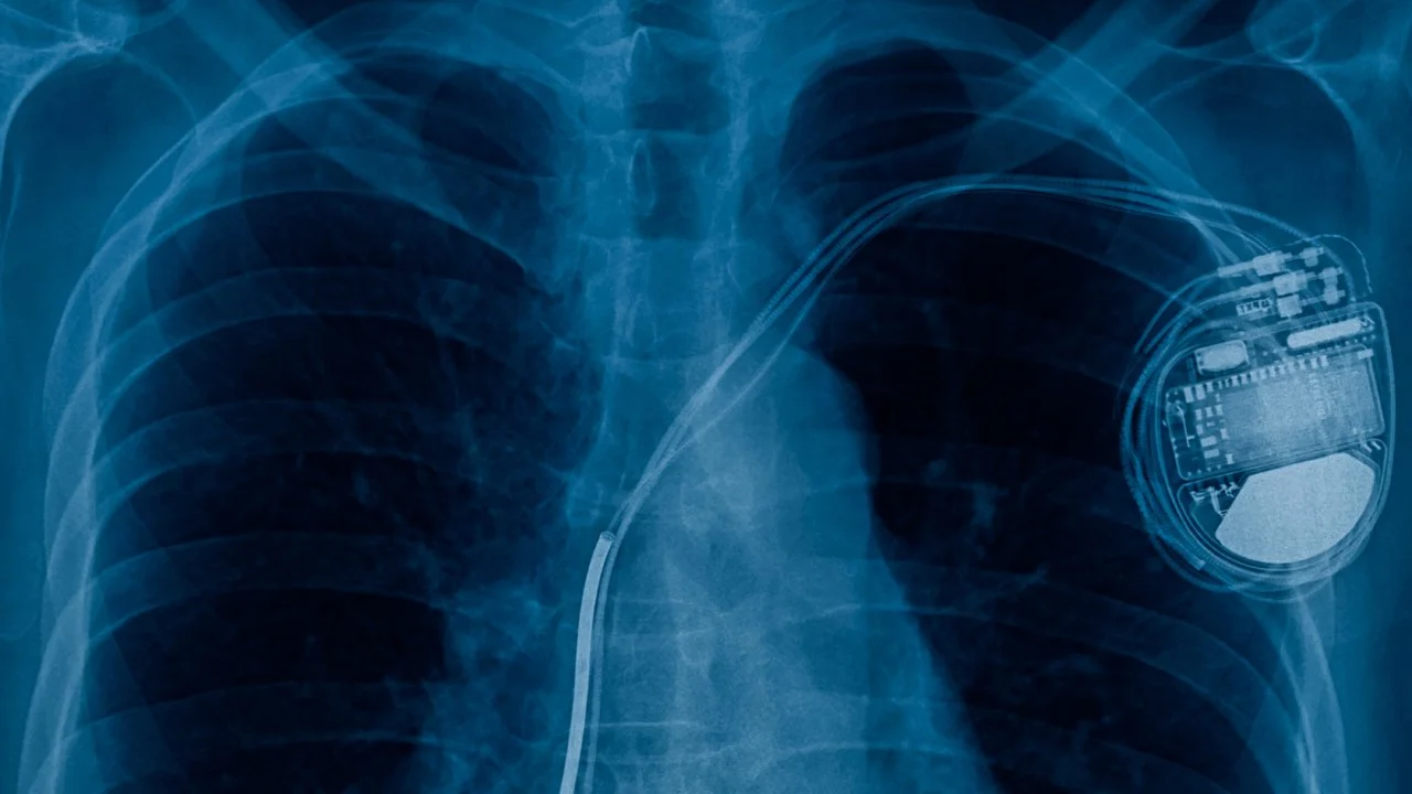 medical-grade-titanium-pacemaker
